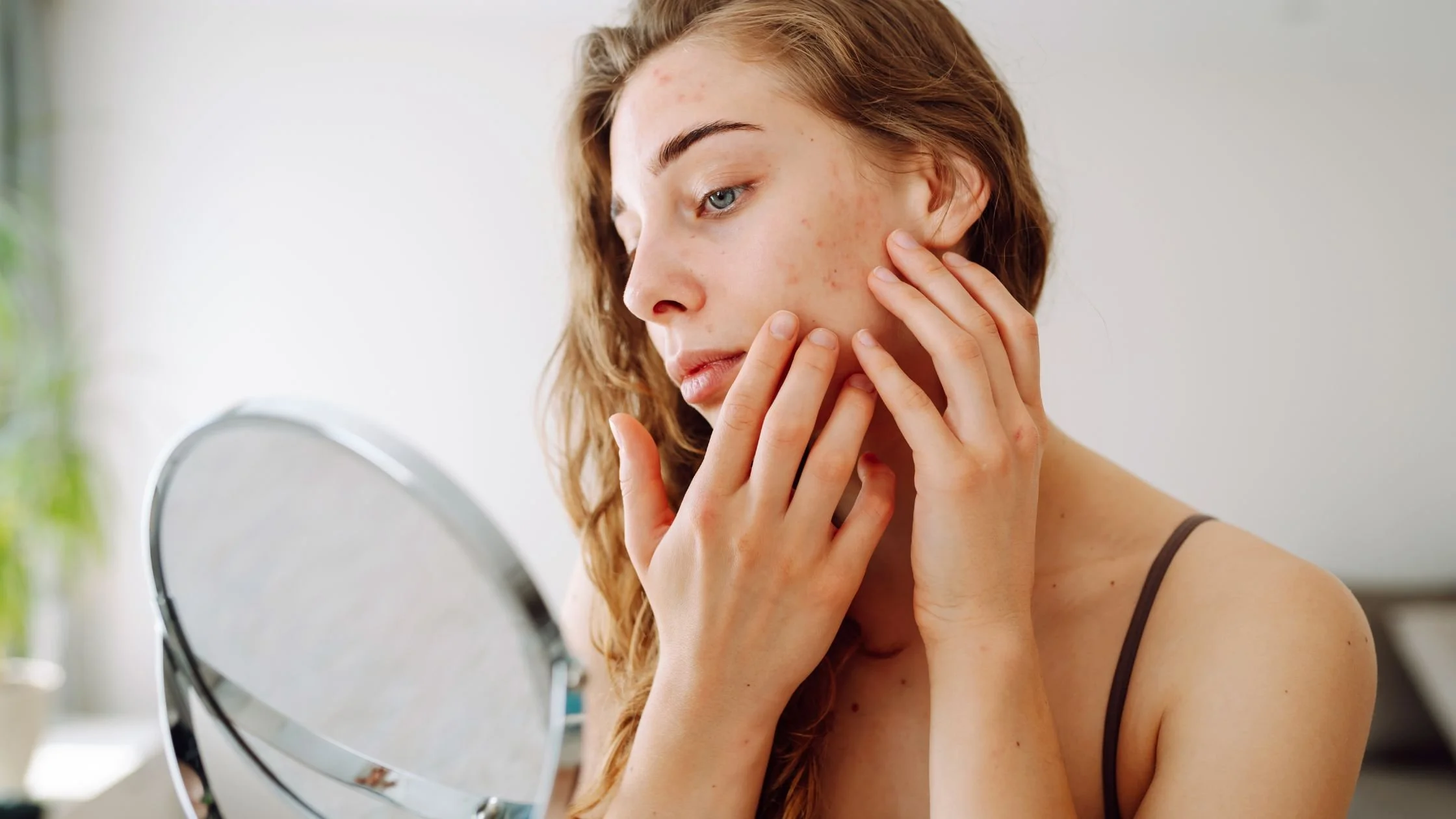 Young woman examining facial skin irritation in the mirror