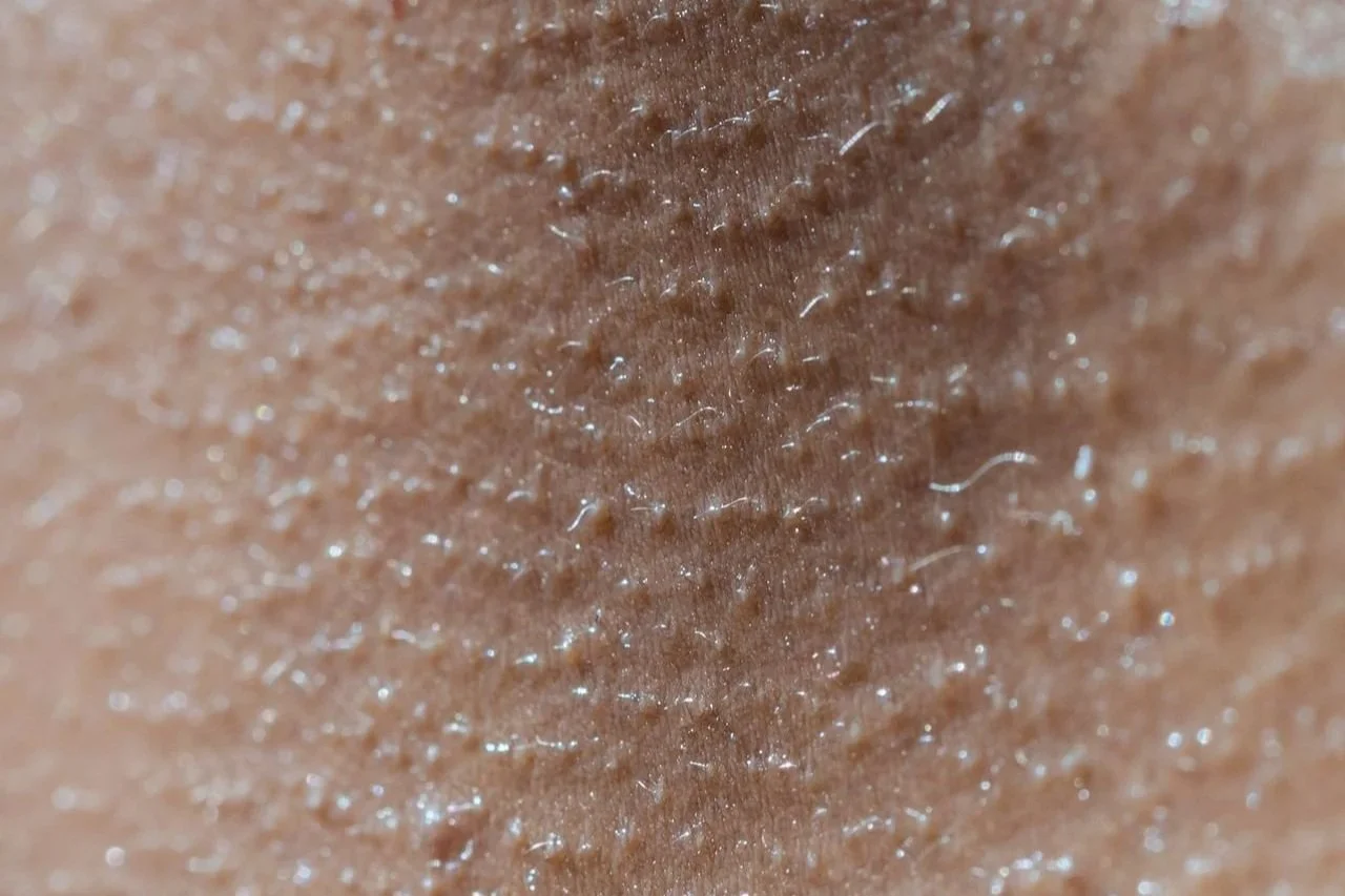 close-up of skin with bumps and hair follicles