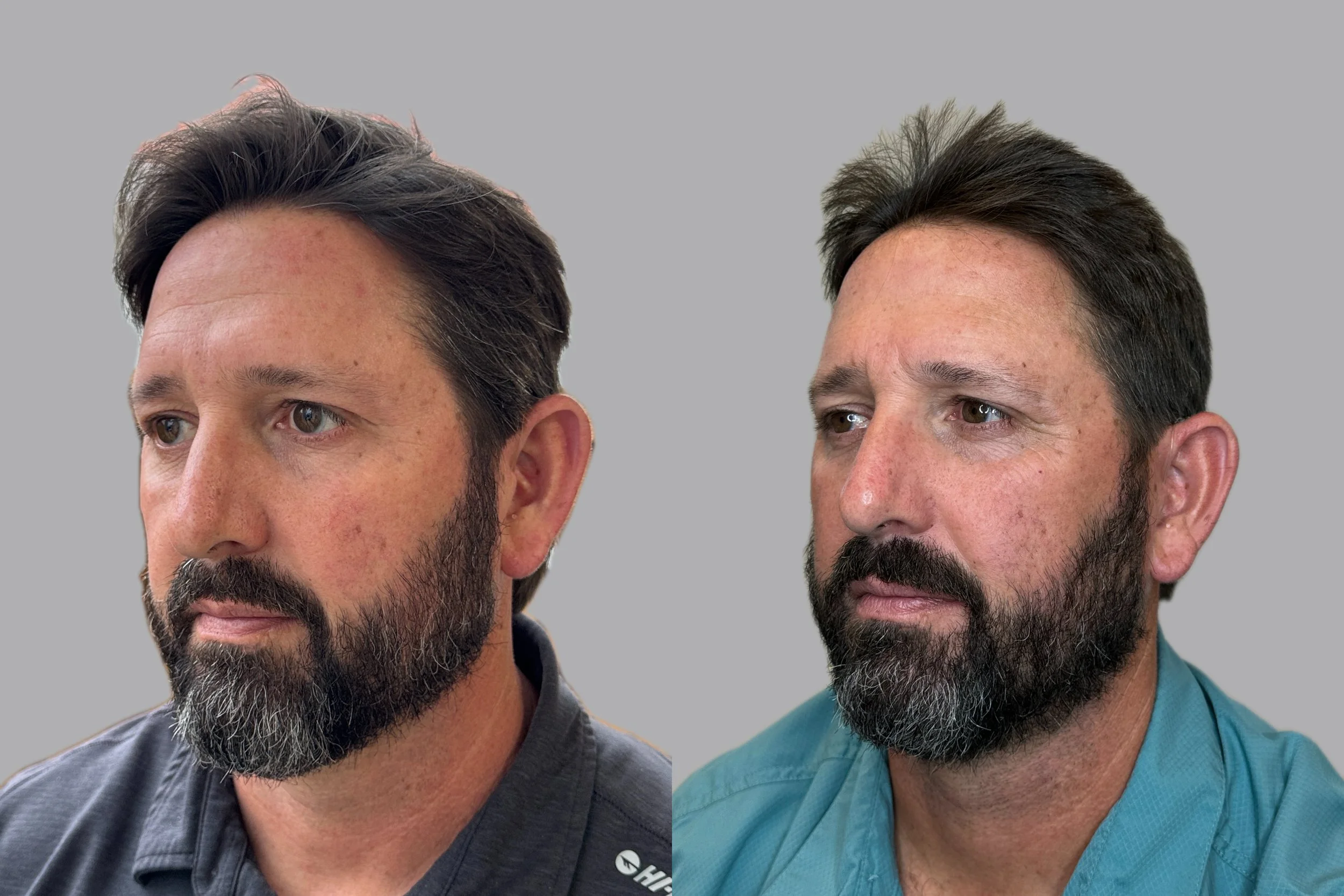 REGENERATIVE-UNDER EYE .jpeg