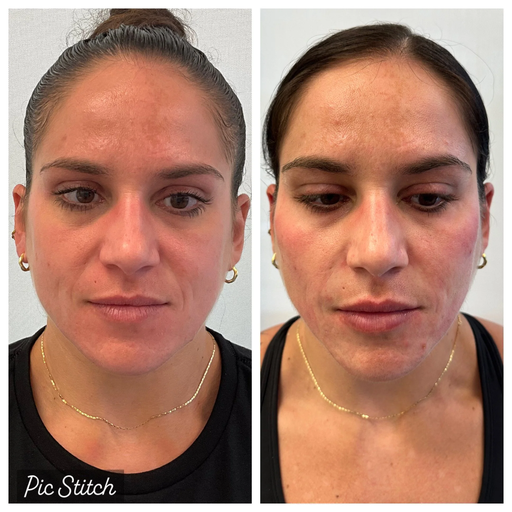 REGENERATIVE_BIOCOLLAGEN STIMULATOR-BLOCK OUT EYES PLEASE.JPG