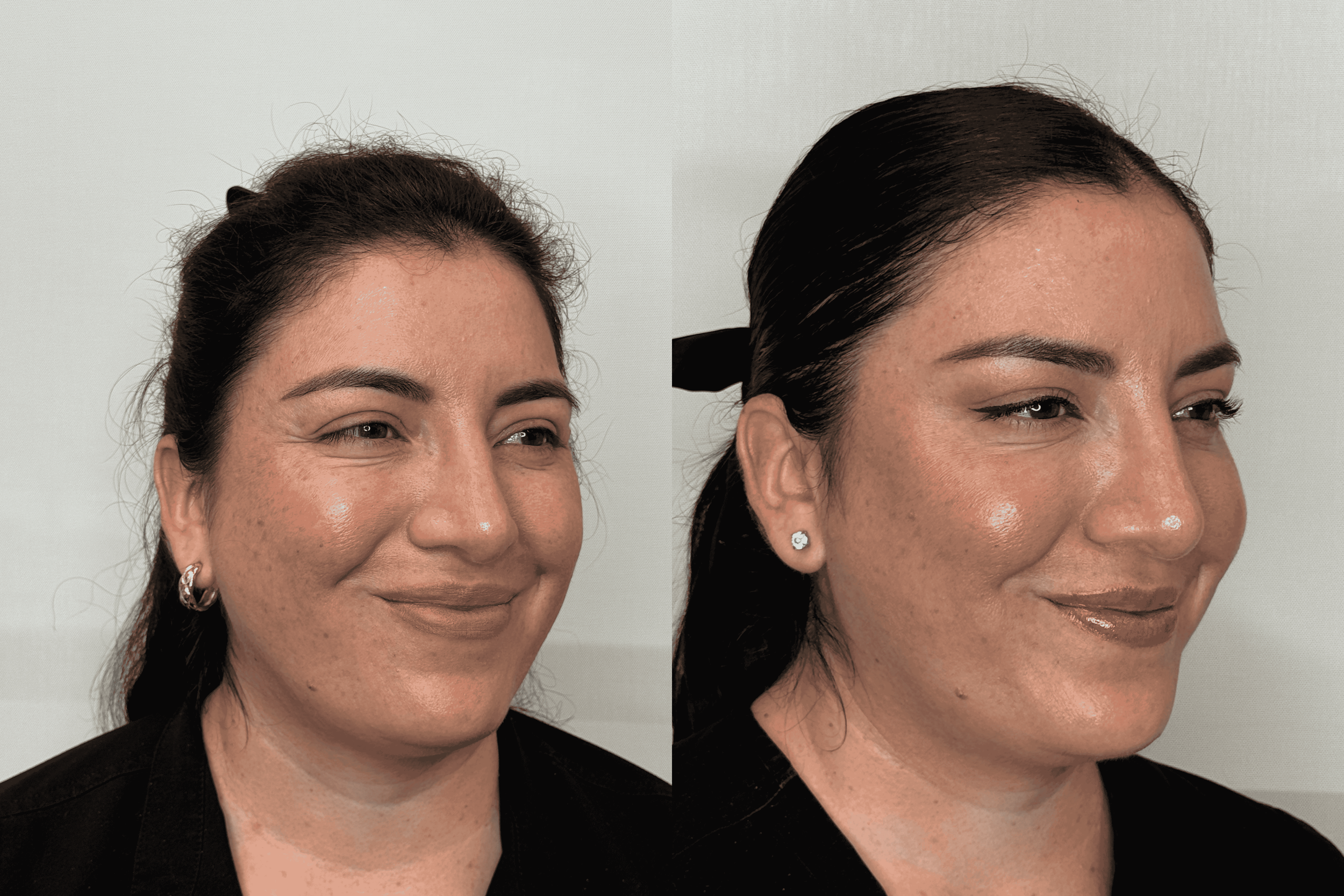Facial balance RM.png