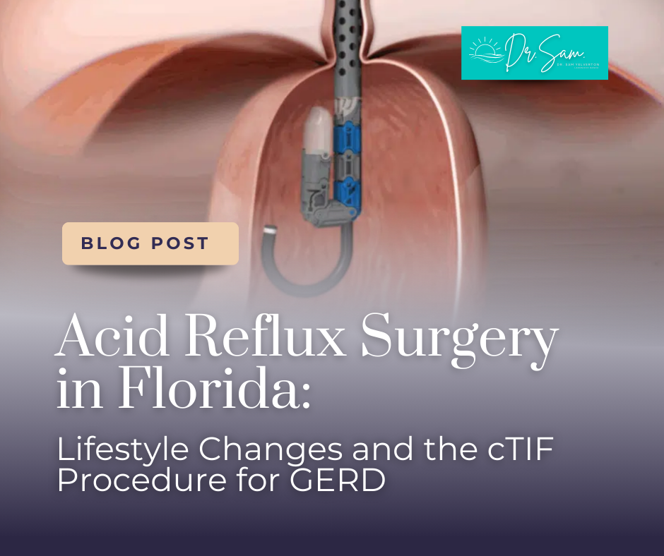 Acid Reflux Surgery in Florida: Lifestyle Changes and the cTIF Procedure for GERD