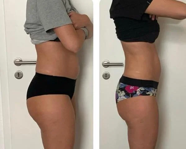 Comparación de antes y después de pérdida de peso en una mujer, mostrando cambios en la figura corporal.