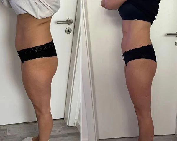 Comparación de dos fotos de un cuerpo femenino, mostrando cambios en la figura, probablemente resultado de un proceso de ejercicio o dieta.