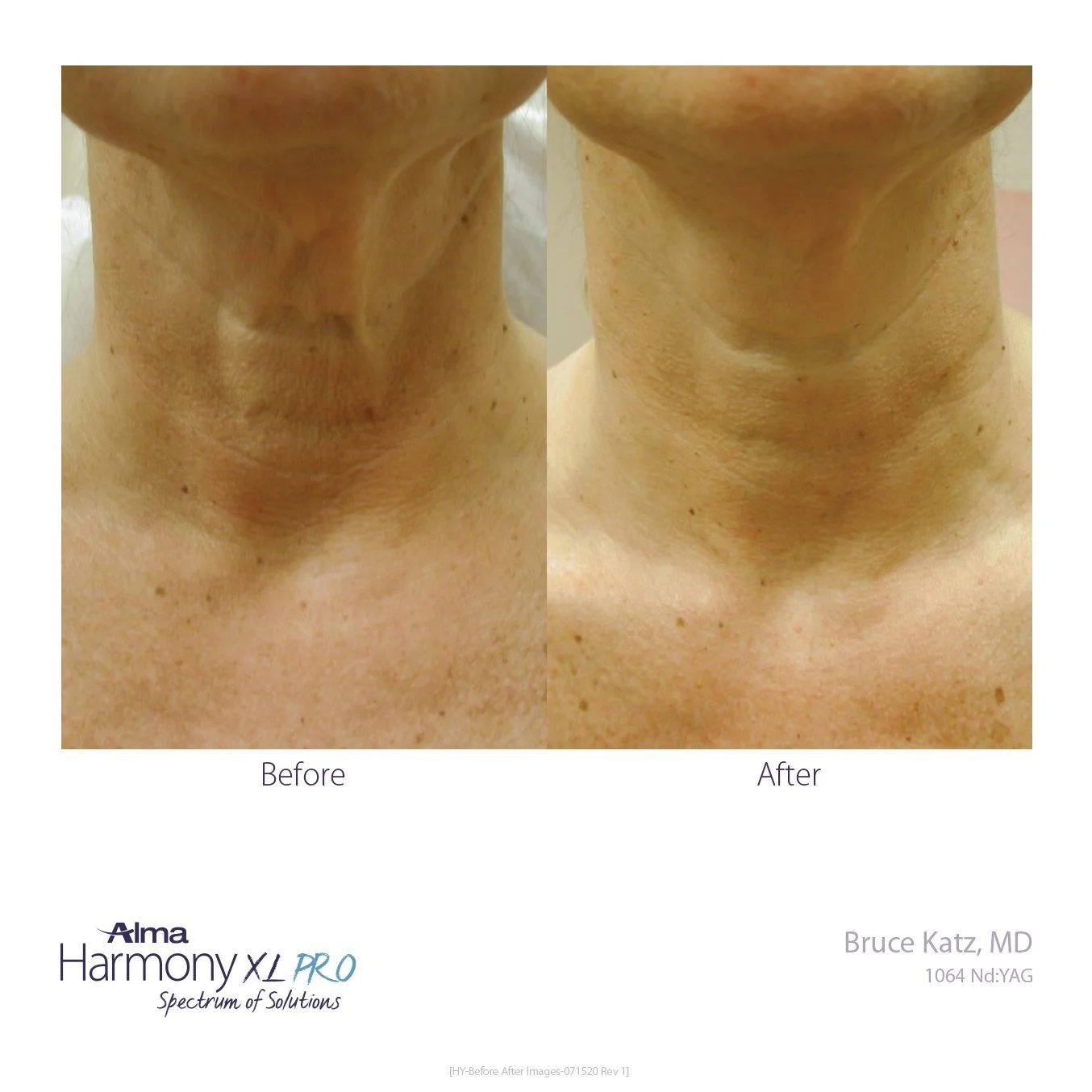 HY-Before-and-After-B2C-27.jpg