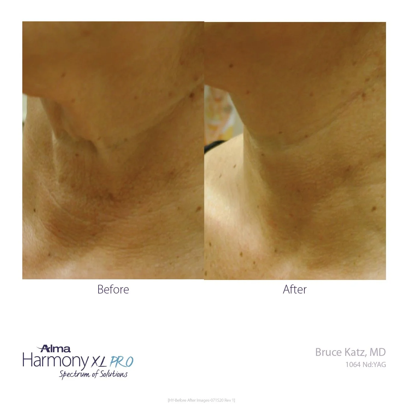 HY-Before-and-After-B2C-29.jpg