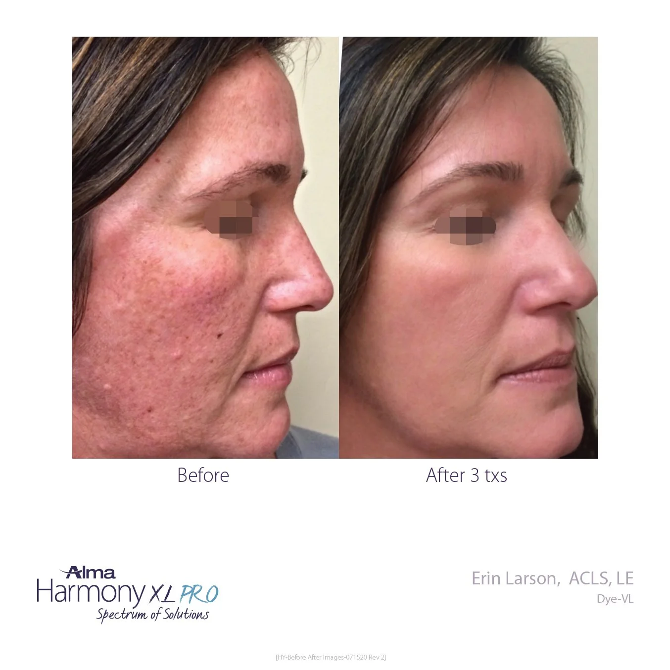 HY-Before-and-After-B2C-03.jpg