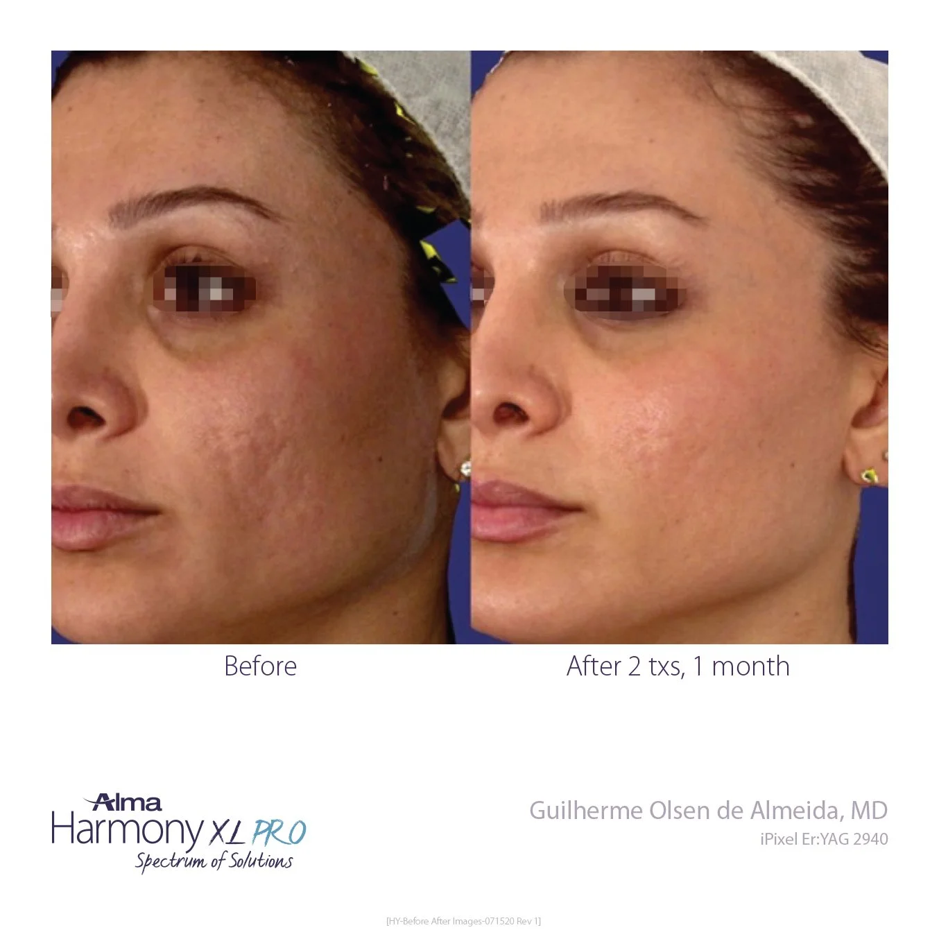 HY-Before-and-After-B2C-39.jpg