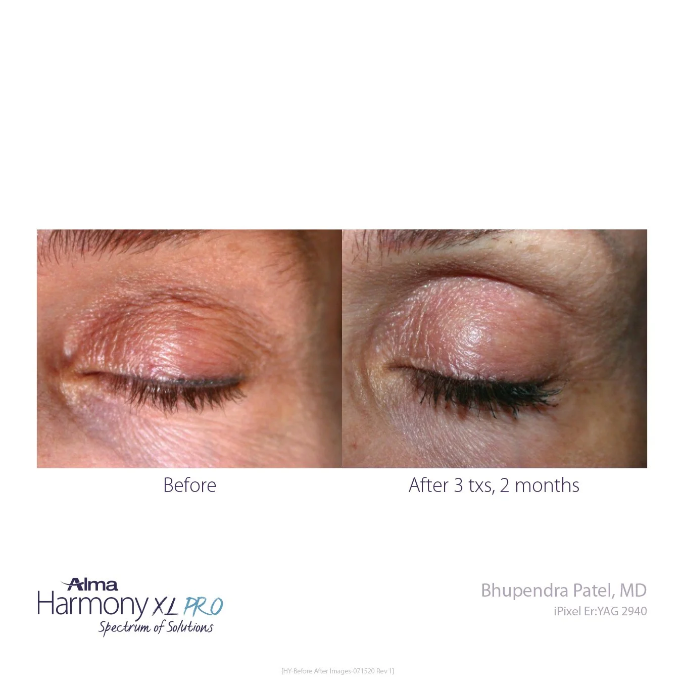 HY-Before-and-After-B2C-40.jpg