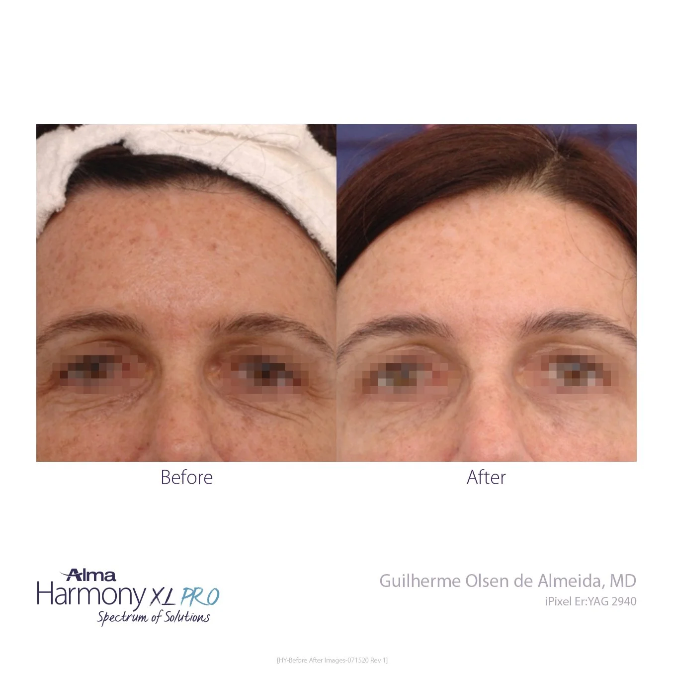 HY-Before-and-After-B2C-43.jpg