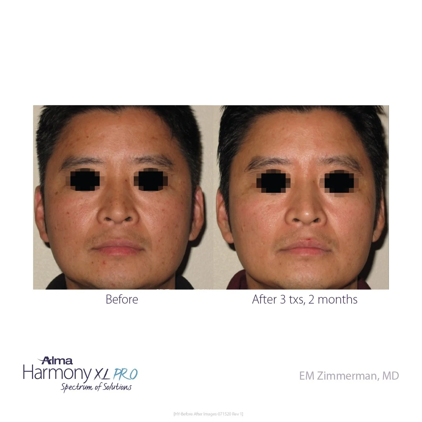 HY-Before-and-After-B2C-47.jpg