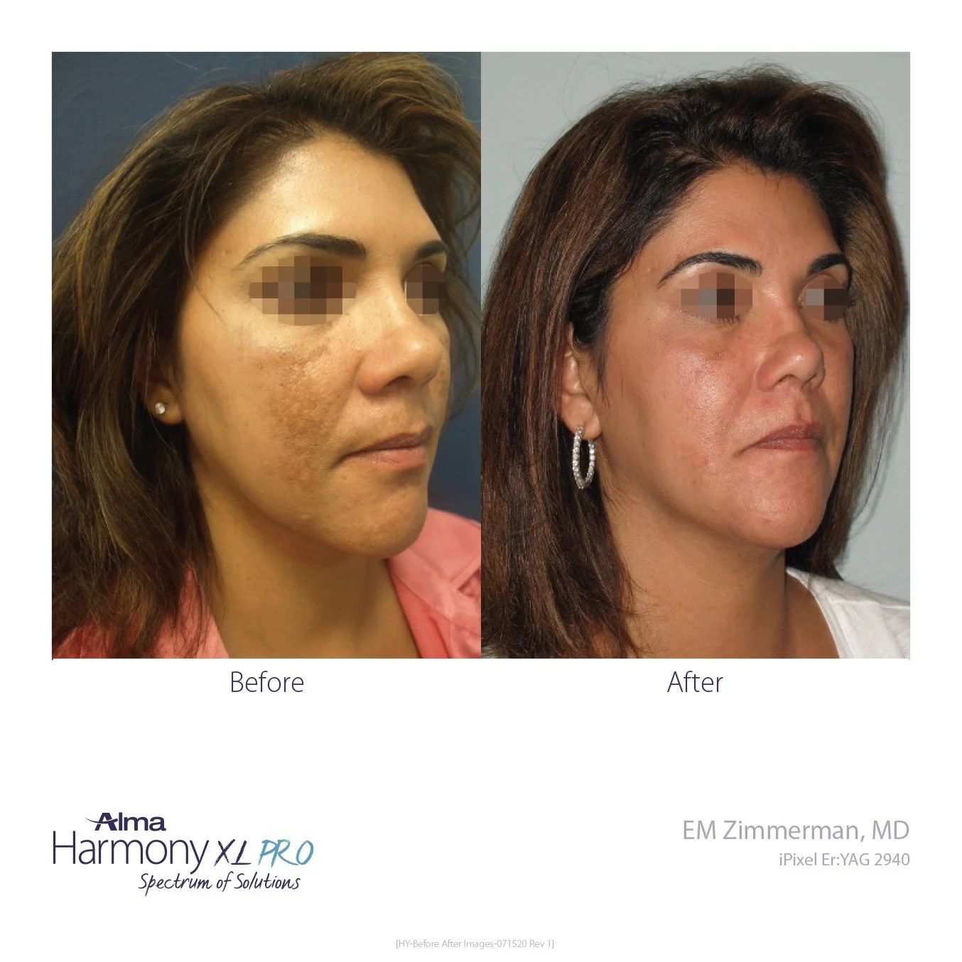 HY-Before-and-After-B2C-52.jpg