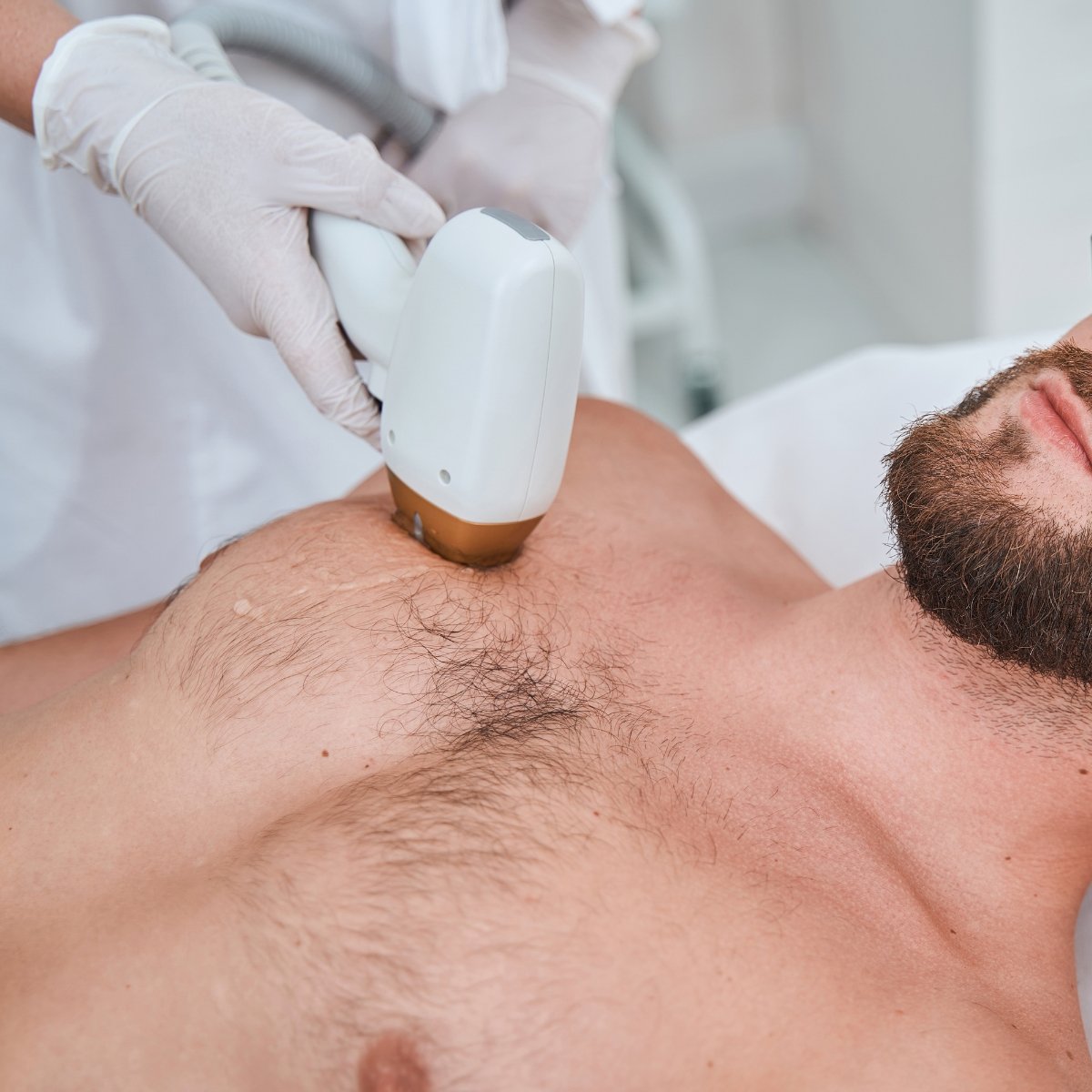 Laser Hair Removal.jpg