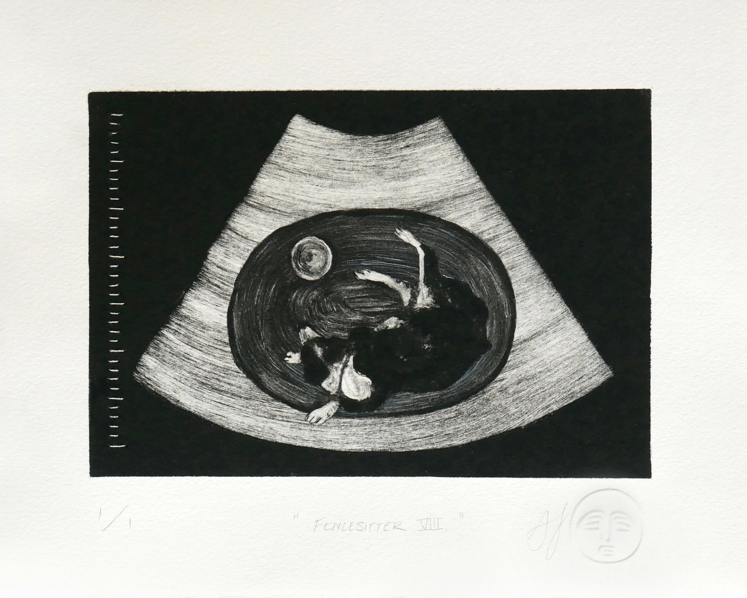 Fencesitter VIII.

Alt Text: Black and white monotype print of a sonogram containing a top-down view of a cattle dog curled up on a rug