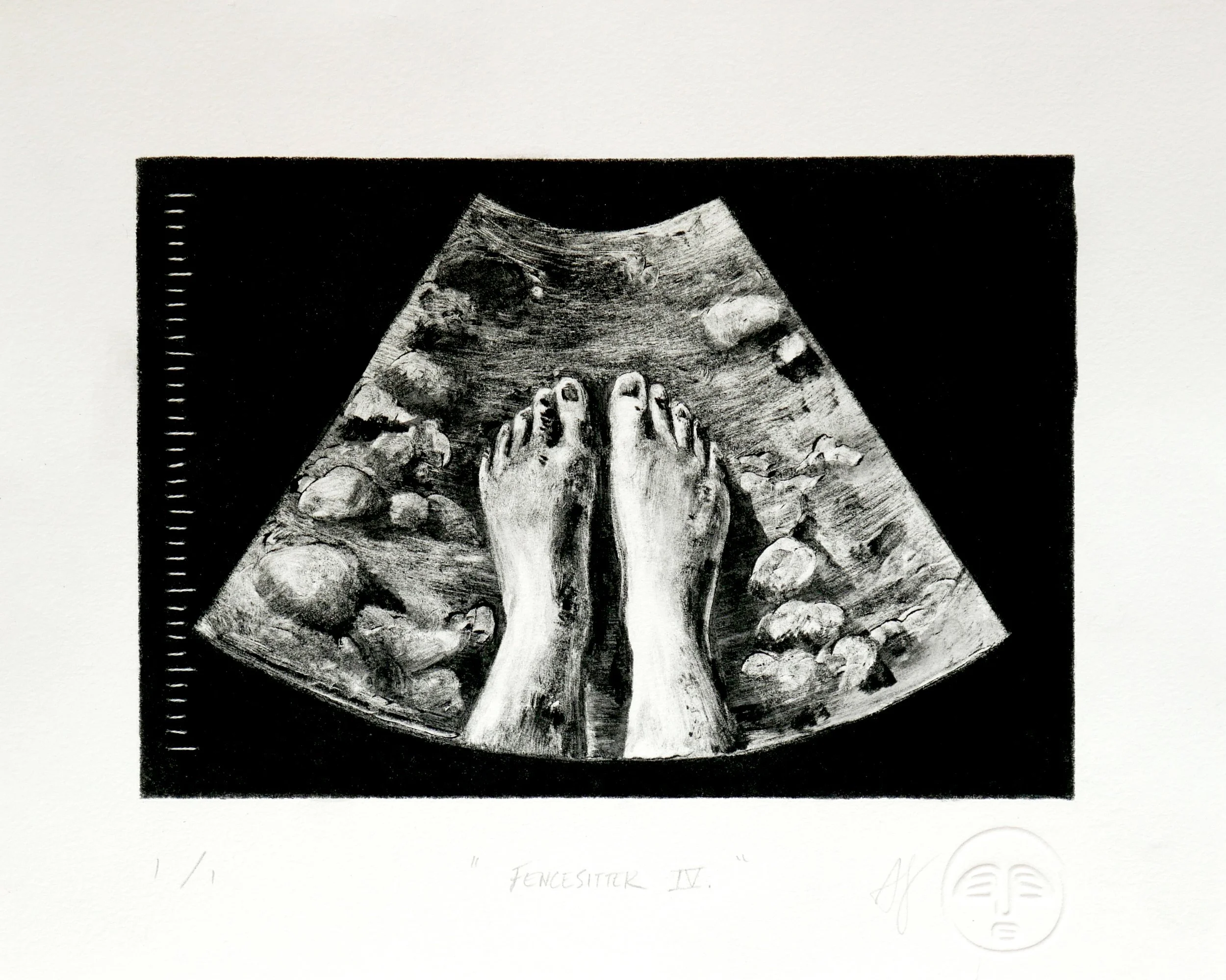 Black and white monotype print of a sonogram containing a view looking down at bare feet in a rocky river bed
