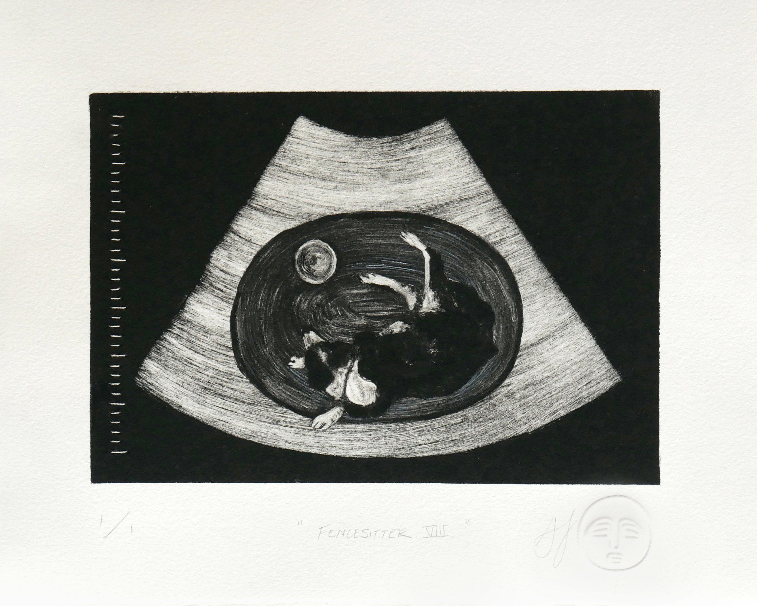 Black and white monotype print of a sonogram containing a top-down view of a cattle dog curled up on a rug