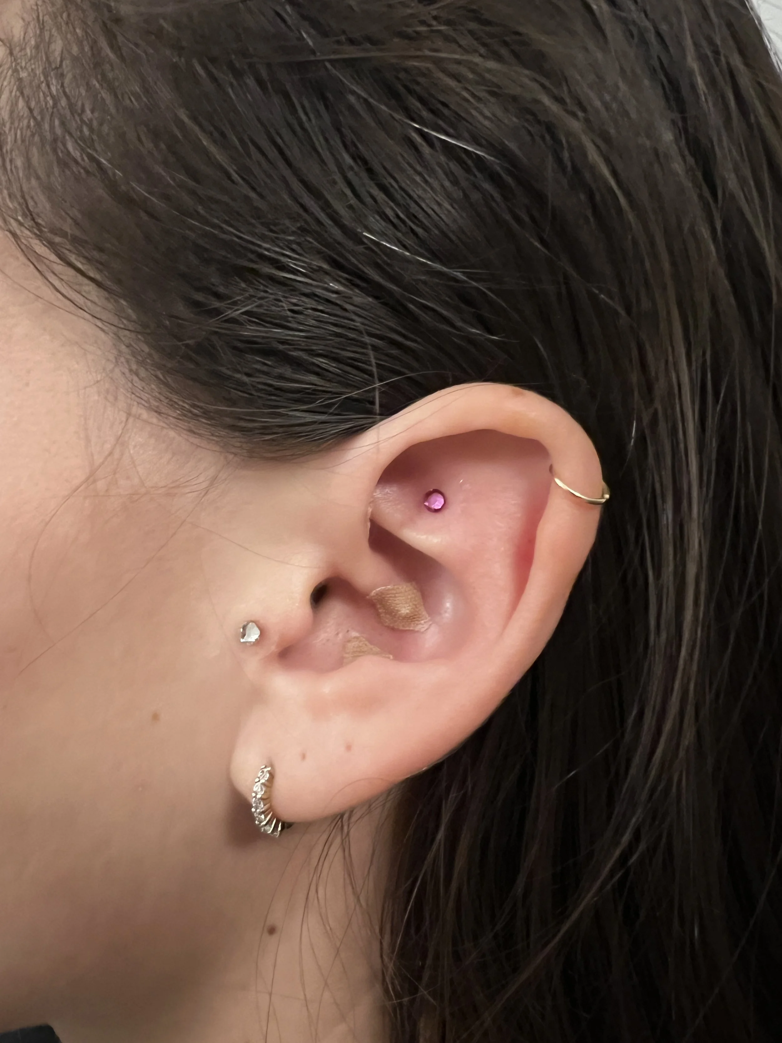 Rachael L ear Stress.JPG