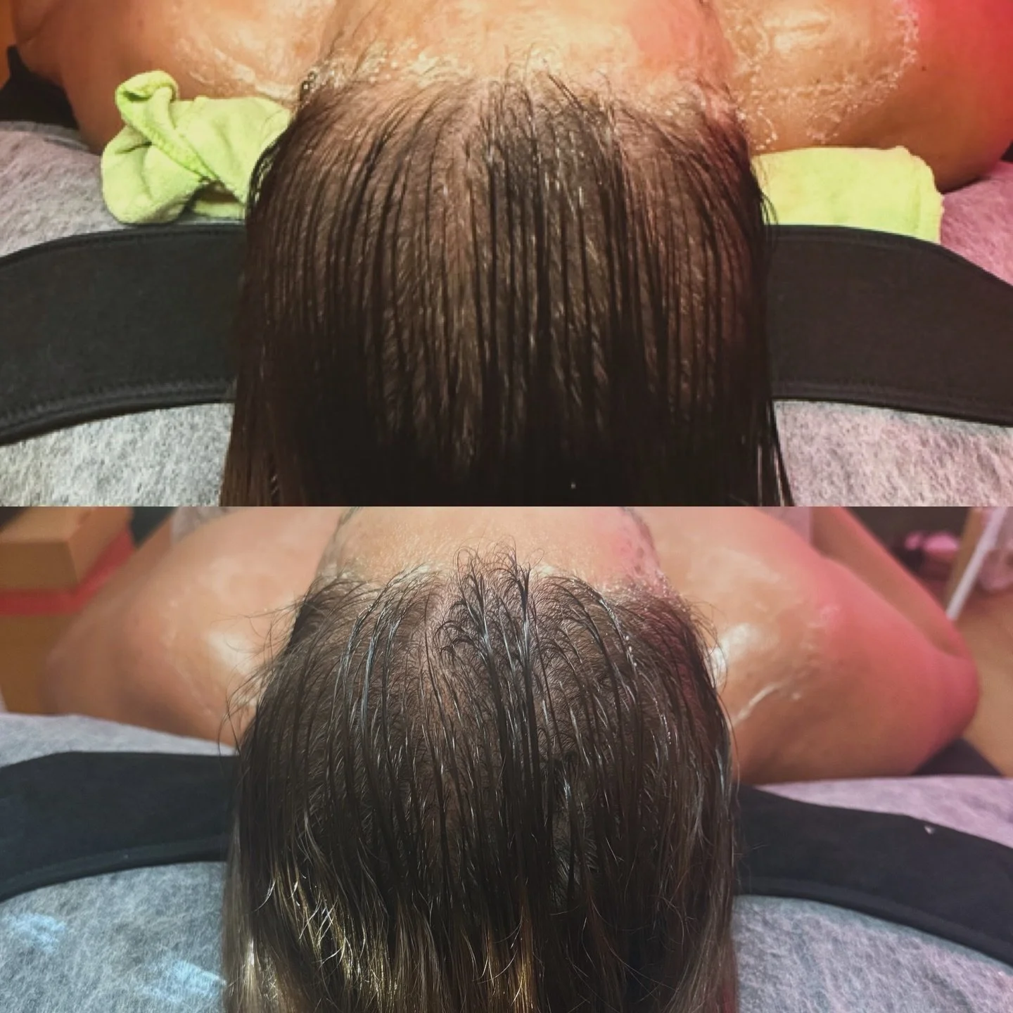 Two sessions in&hellip; and the difference speaks for itself ✨
Healthier scalp = stronger, fuller-looking hair.

Scalp therapy isn&rsquo;t just about hair growth&mdash;it&rsquo;s about improving circulation, reducing congestion, and creating the idea