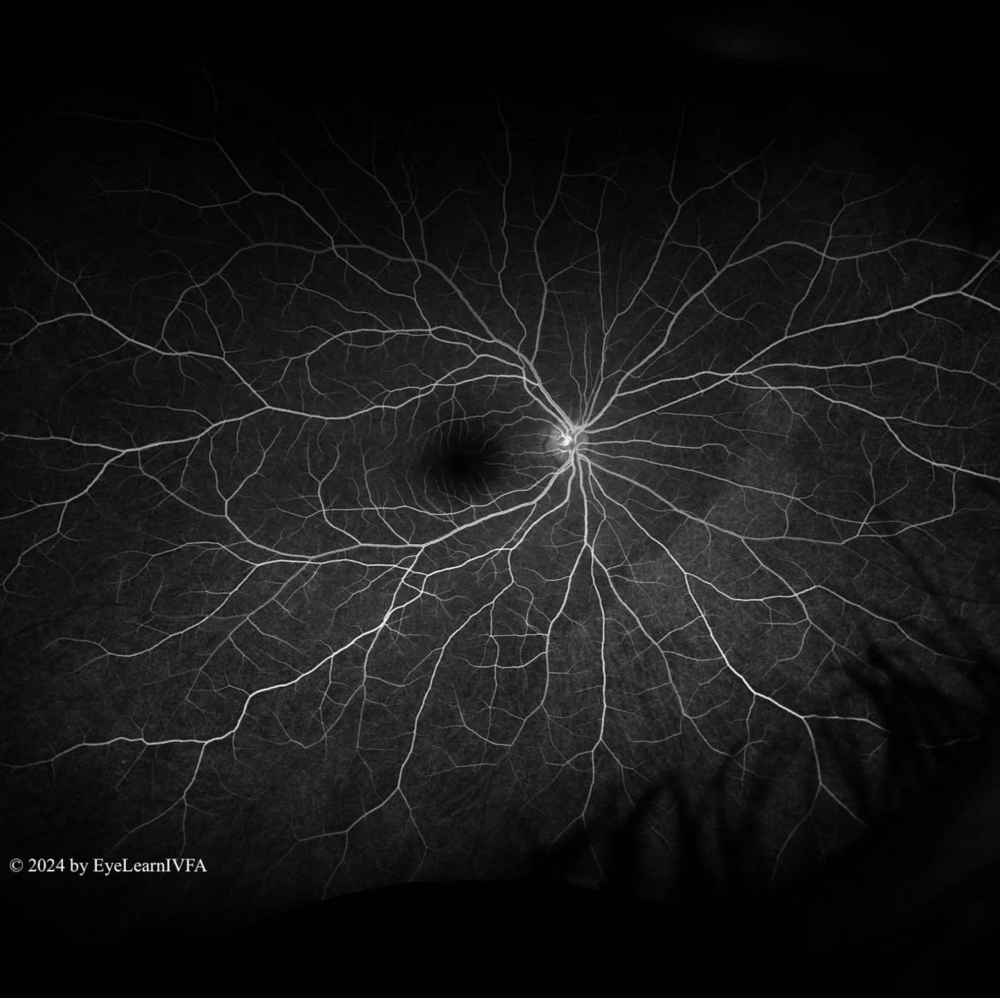 Ivfa Liverpool Phases of IVFA — EyeLearnIVFA