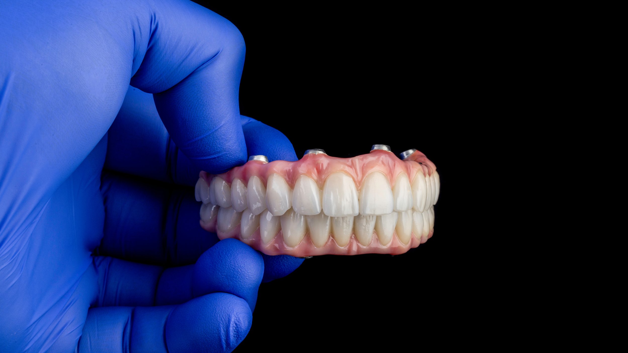 Implant Denture Atlanta.jpeg