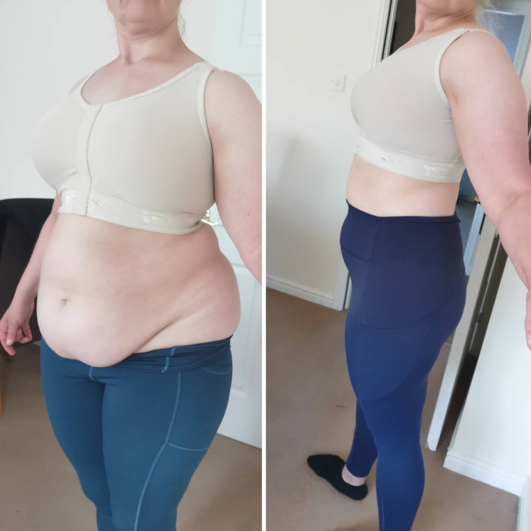 21 Day Reset Result - Before and After Image