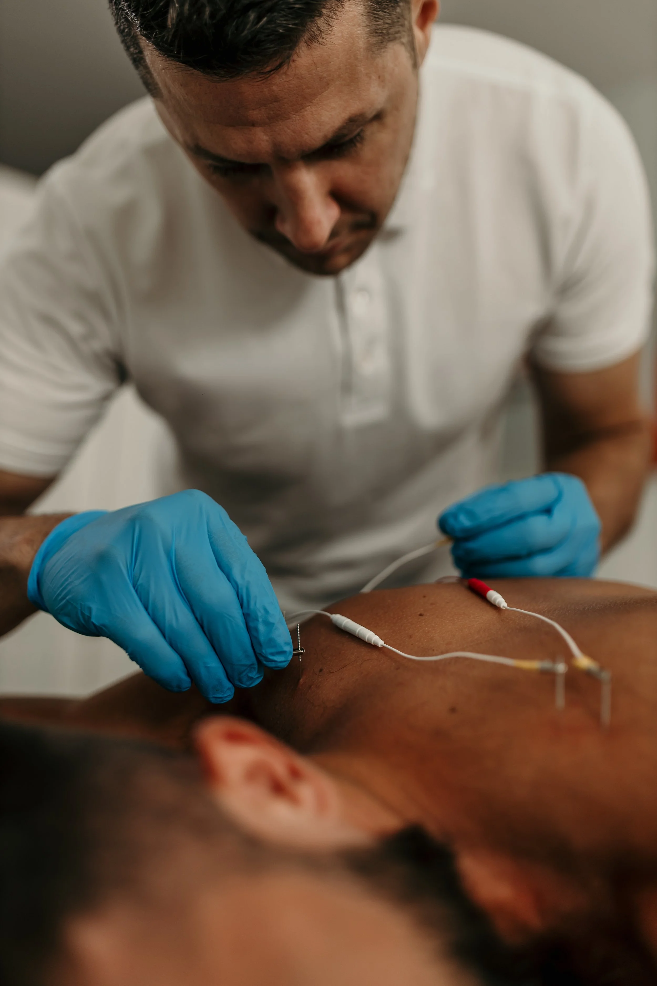 A medical professional inserting acupuncture needles into a patient's chest.