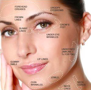 Brow Lift