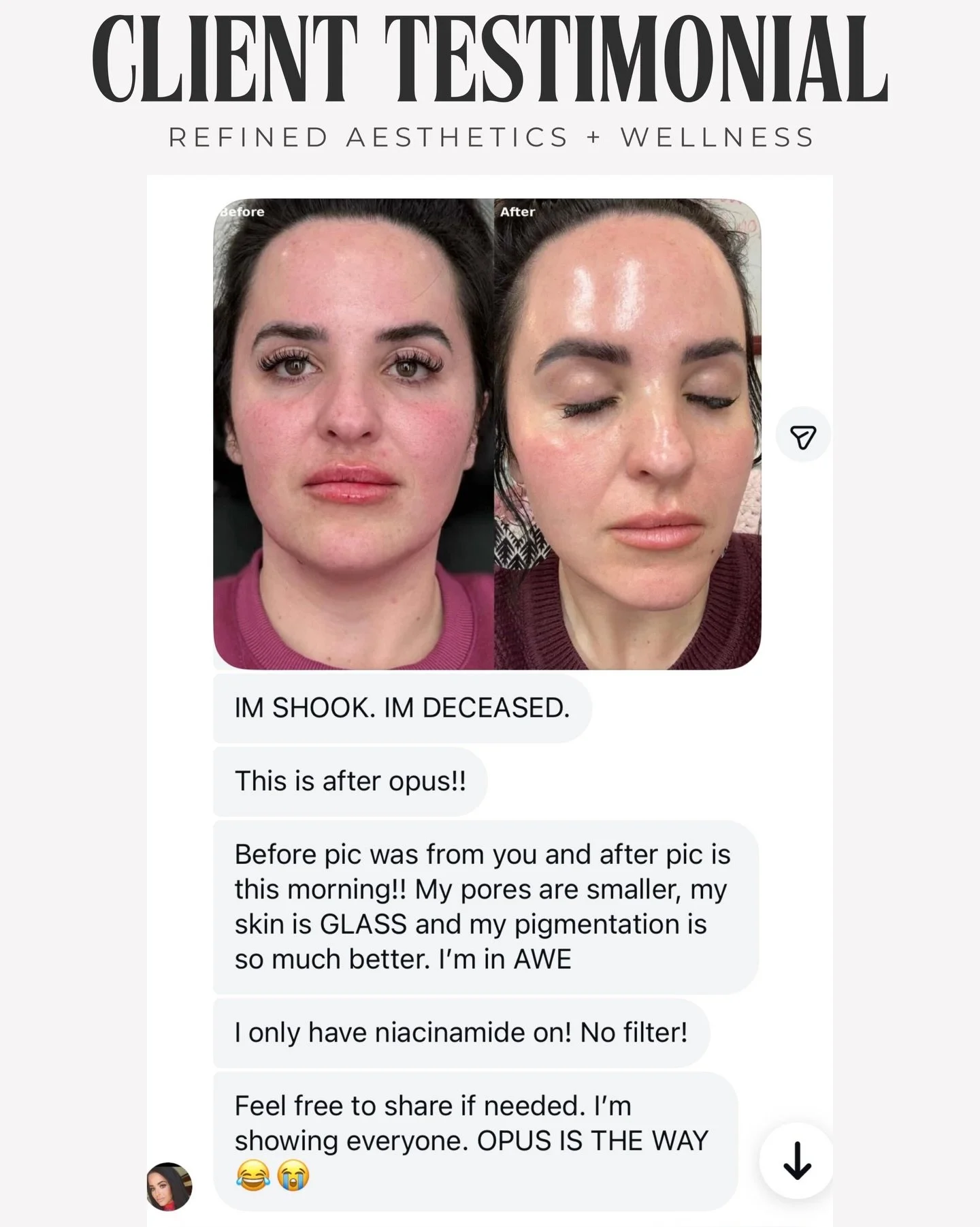 We love nothing more than happy clients 🥹

This sweet client of ours is stunning inside and out and we are grateful to be apart of her journey finding confidence in herself again. This is what it&rsquo;s all about and we are so honored.

This was a 