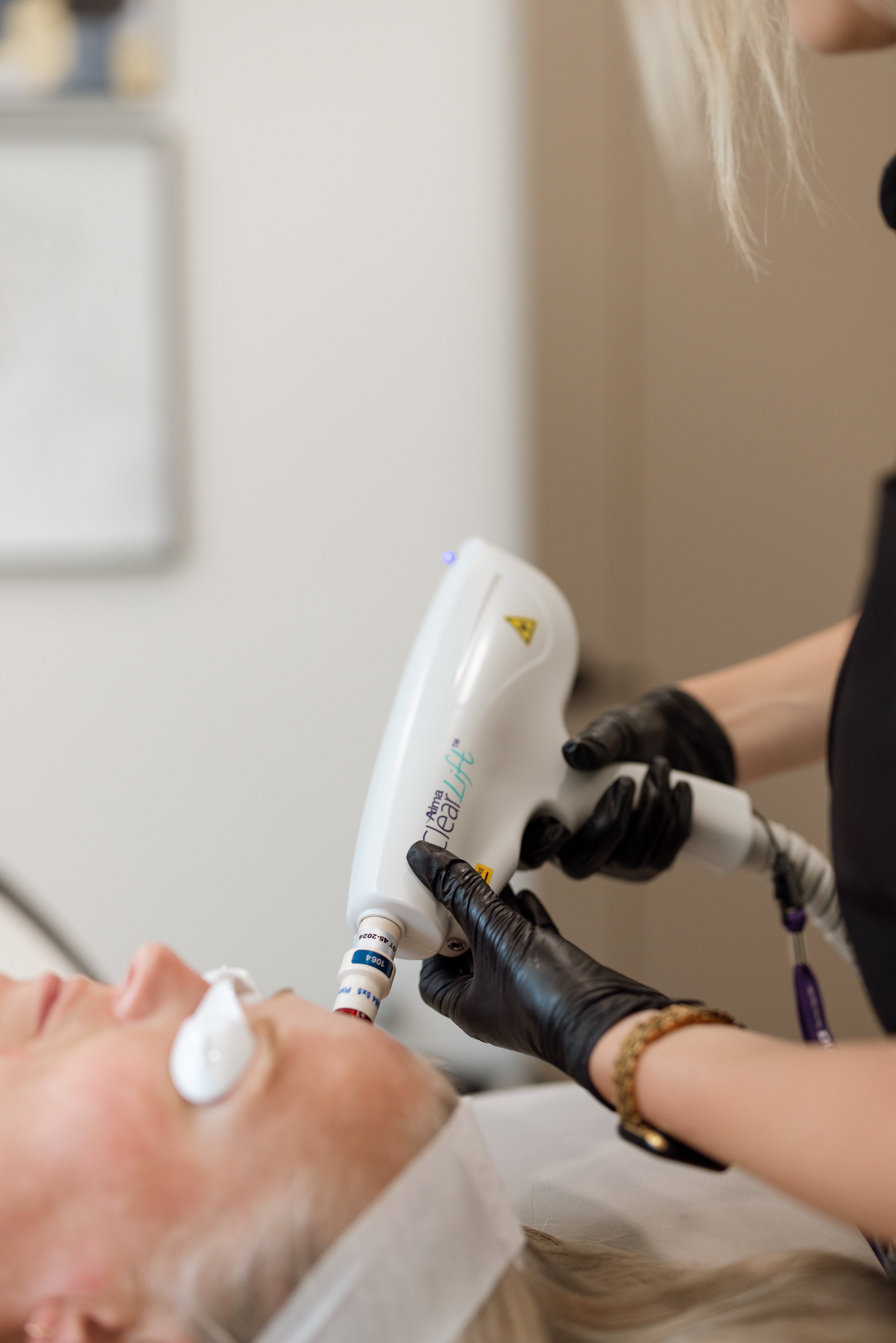 Laser skin treatment at Refined Aesthetics and Wellness in Logan, Utah – advanced technology for pigmentation, hair removal, and skin rejuvenation