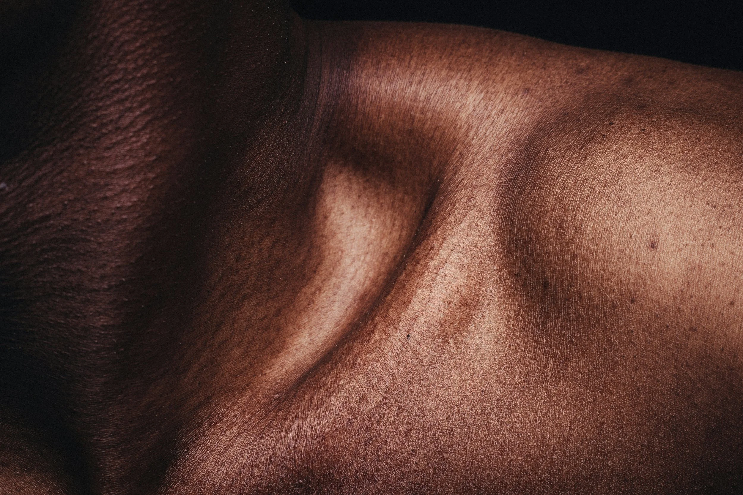 Skin Cancer in Skin of Color: Why the “It Won’t Happen to Me” Myth Is Dangerous