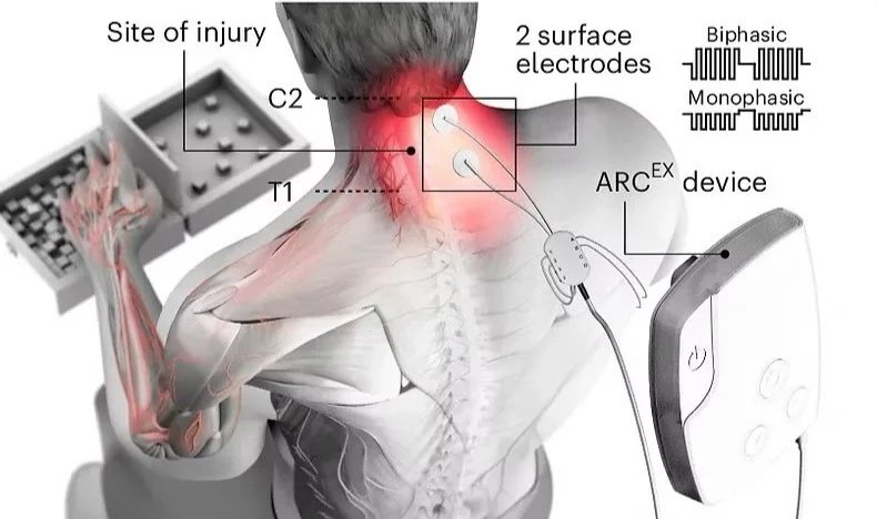 ARC-EX — Revive Neurorecovery Center