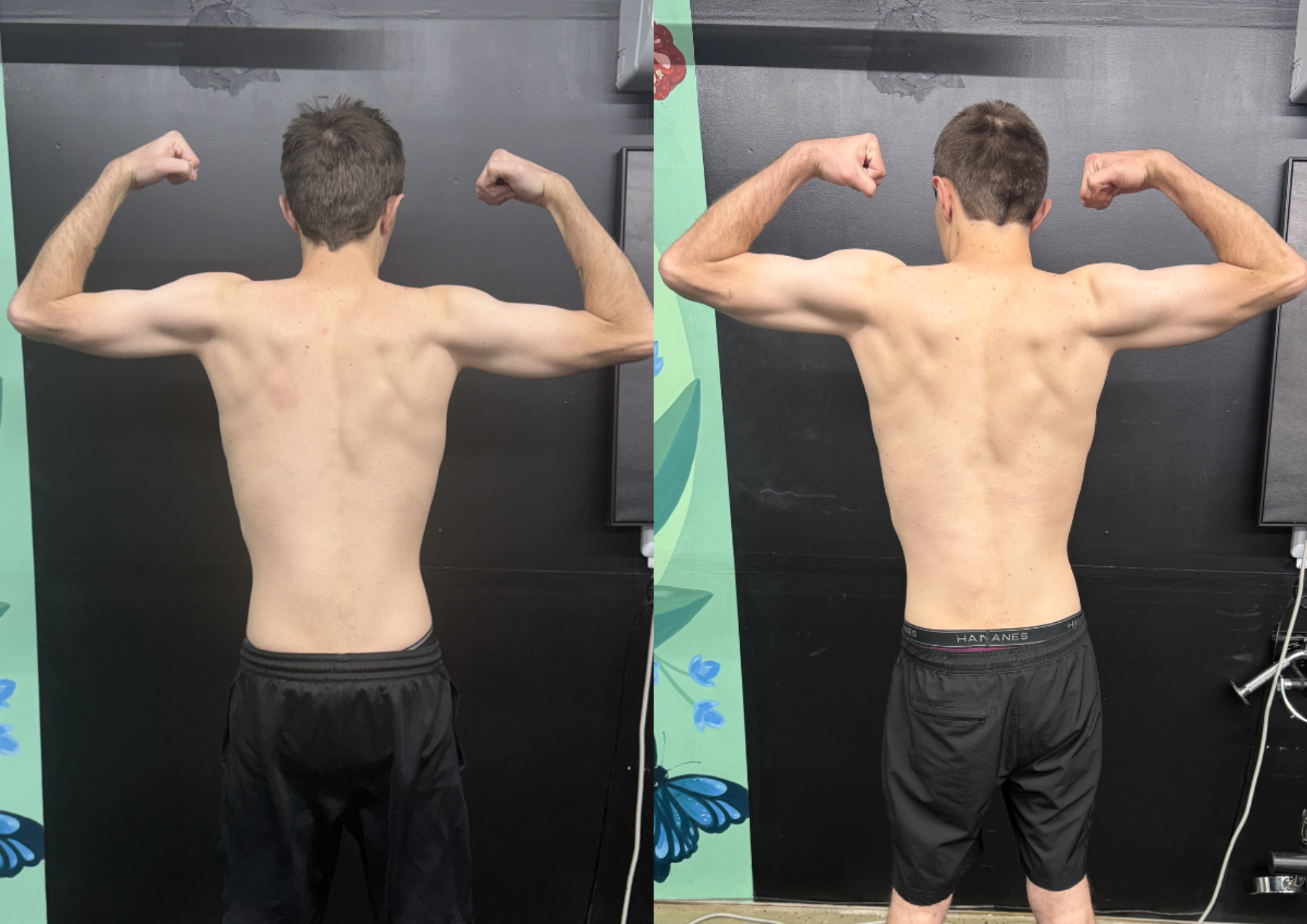 Flexing client showing increased muscle in his back and biceps.