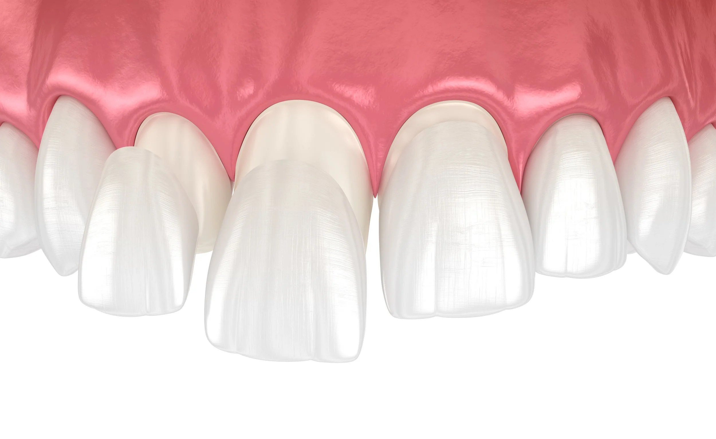 hat Does a Cosmetic Dentist in Wilsonville, OR Offer?