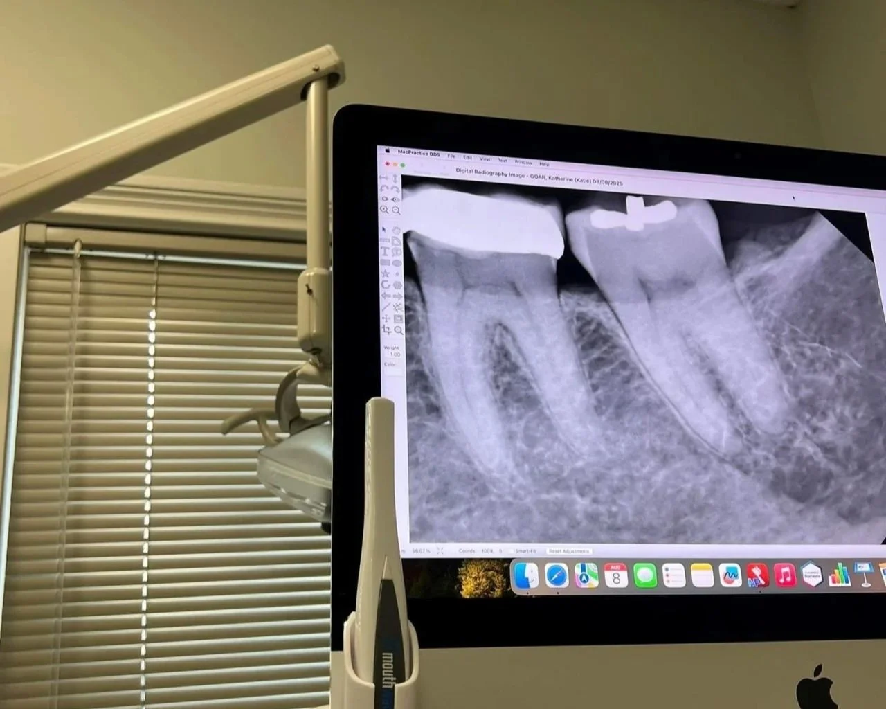 From Root Canal to Real Security