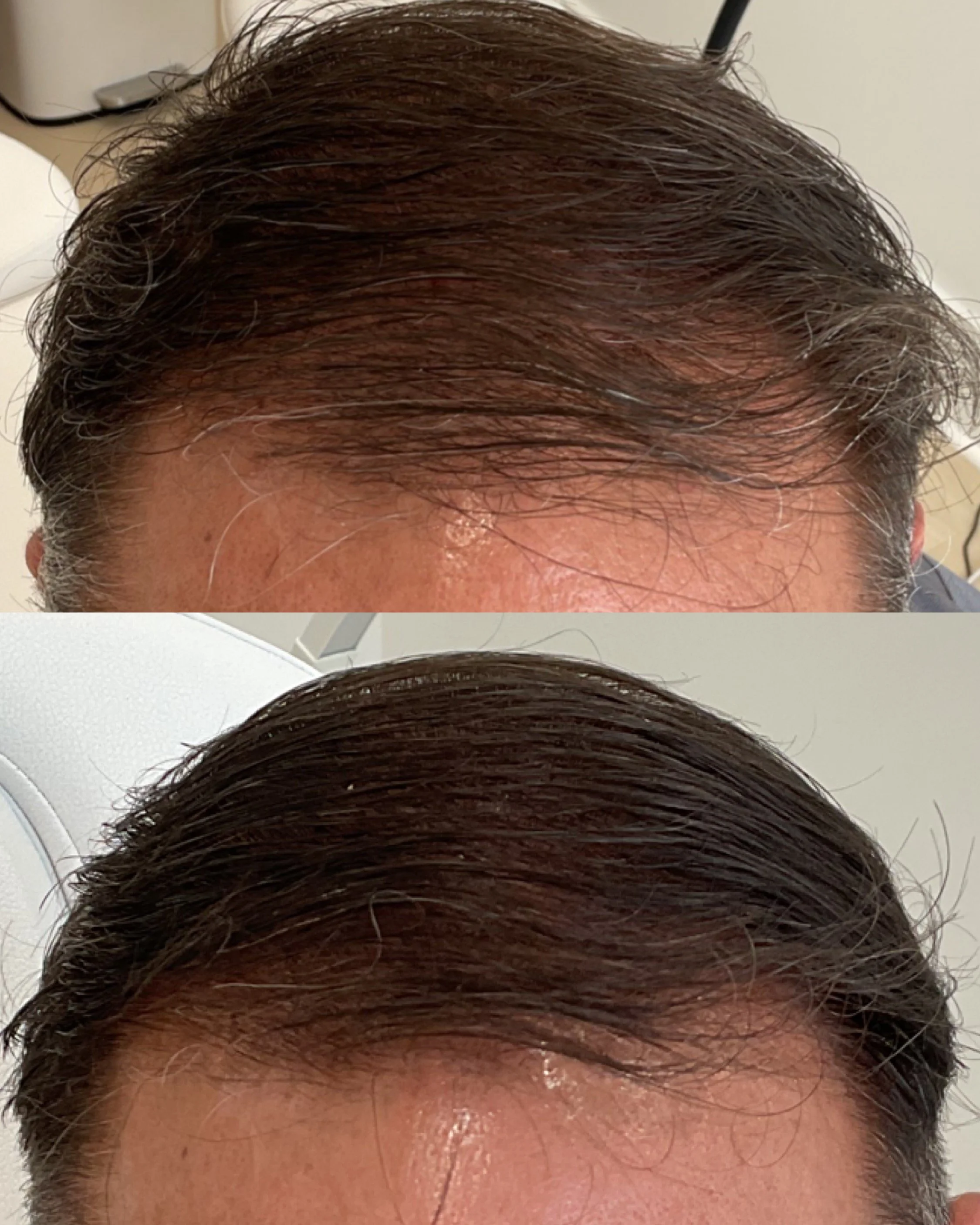 Revitalize Your Hair Naturally at Beaufort Aesthetics – Non-Invasive Hair Restoration in the Lowcountry