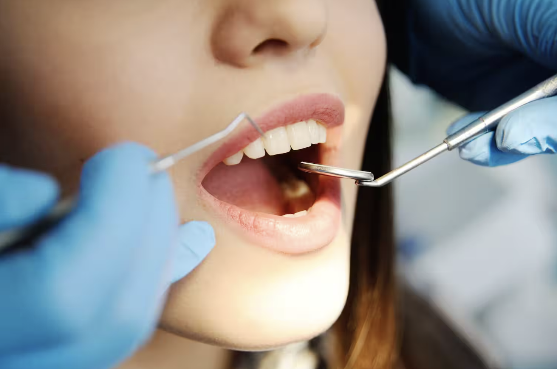Votre dentiste est-il sur la liste noire de votre assureur ?