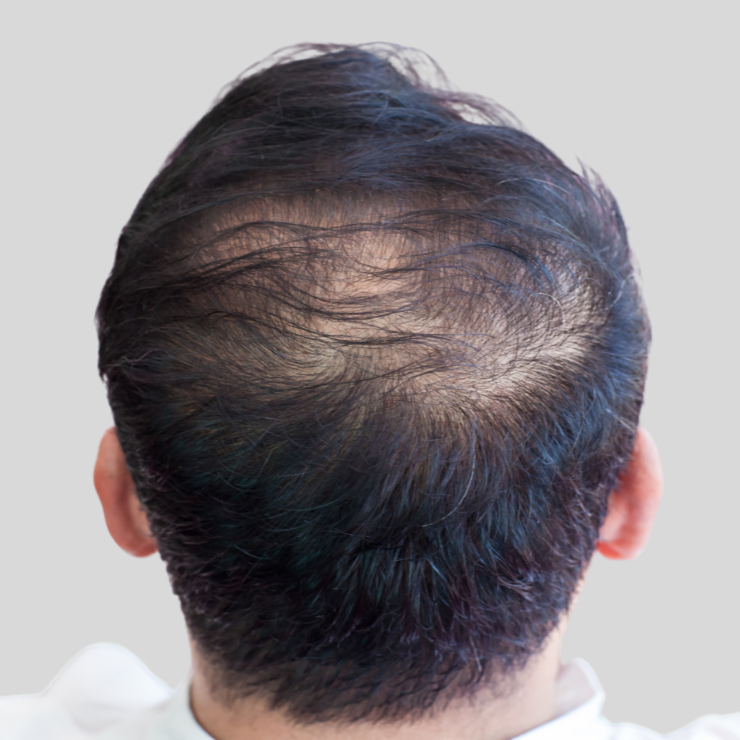 SMP Density No BG.png