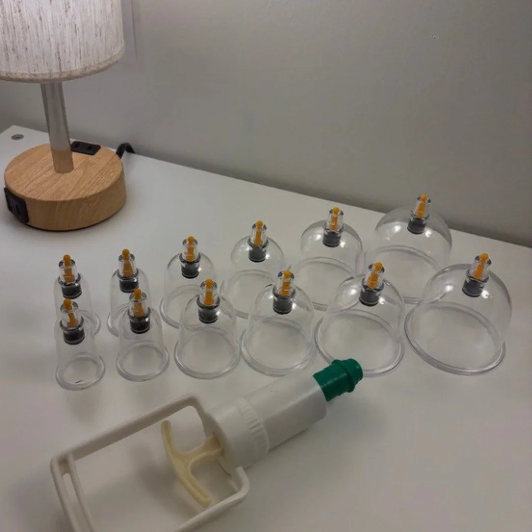 Have you had Cupping Therapy done before??

Cupping Therapy is a therapeutic technique that utilizes a vacuum force created beneath a small vessel applied onto the skin's surface. 

💡 The Procedure Categories💡 
Cupping is typically categorized into