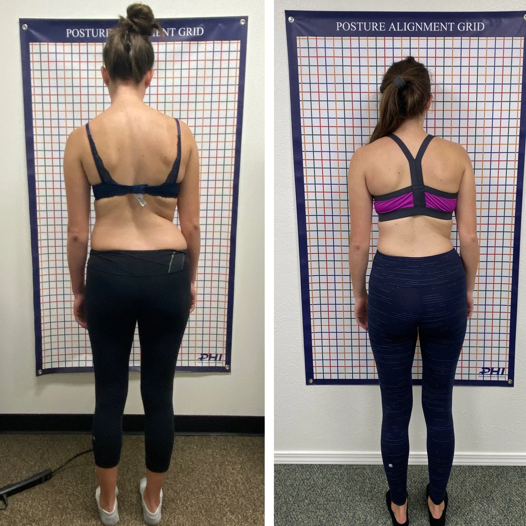 Realign Back Services — Realign Spine