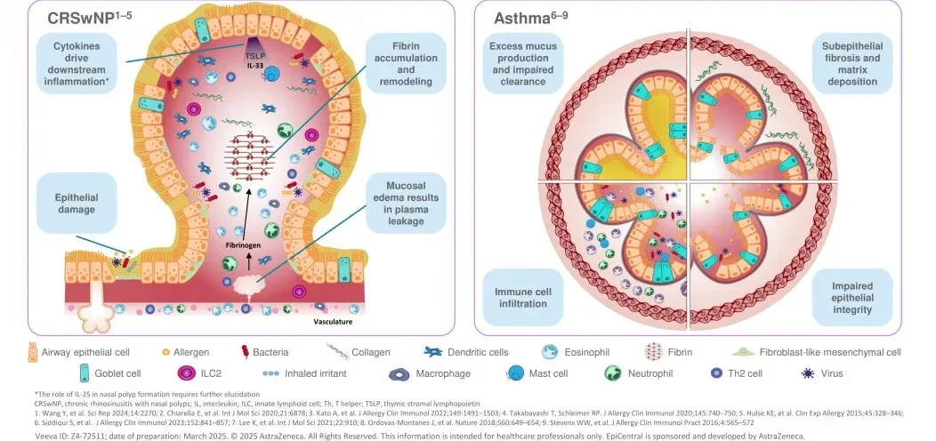 Why is sinusitis a hidden key factor in the difficulty of preventing and treating asthma?