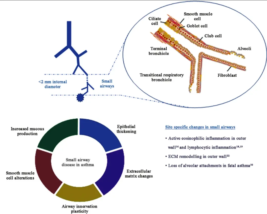 Why are small airways a challenge in the prevention and treatment of asthma?