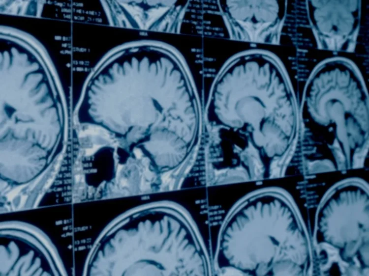 Abc Radiografhy http://radiologists.ab.ca/