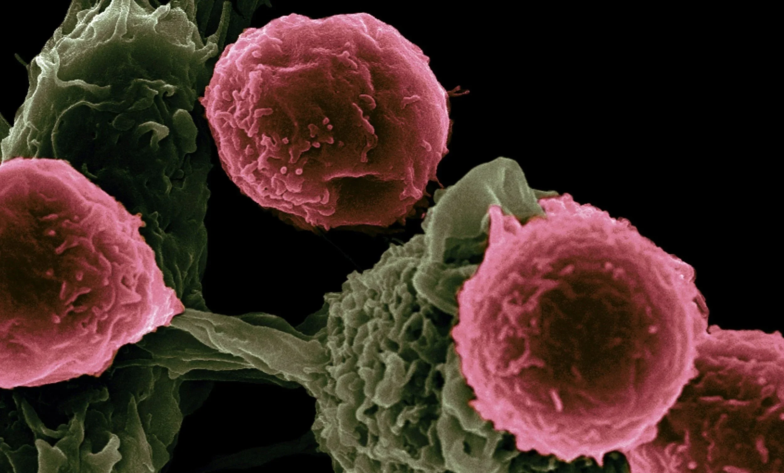 Functional Medicine for Autoimmune Disorders: Root Cause Solutions
