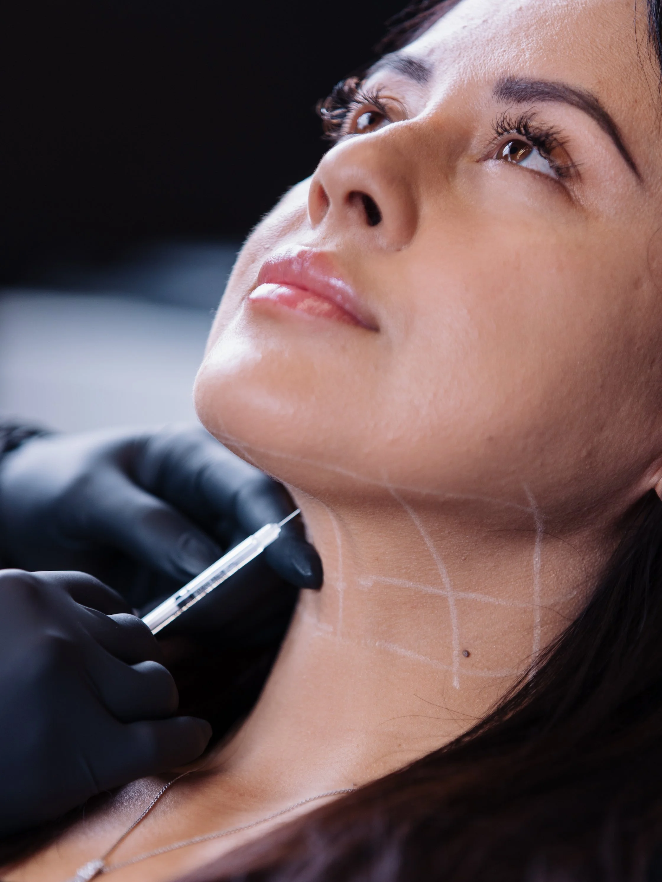 Kybella1.jpg
