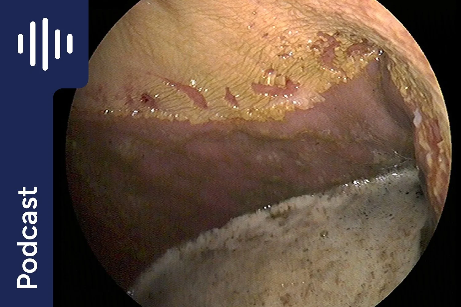 Prevent Gastric Ulcers – Top 3 things you must do for your horse