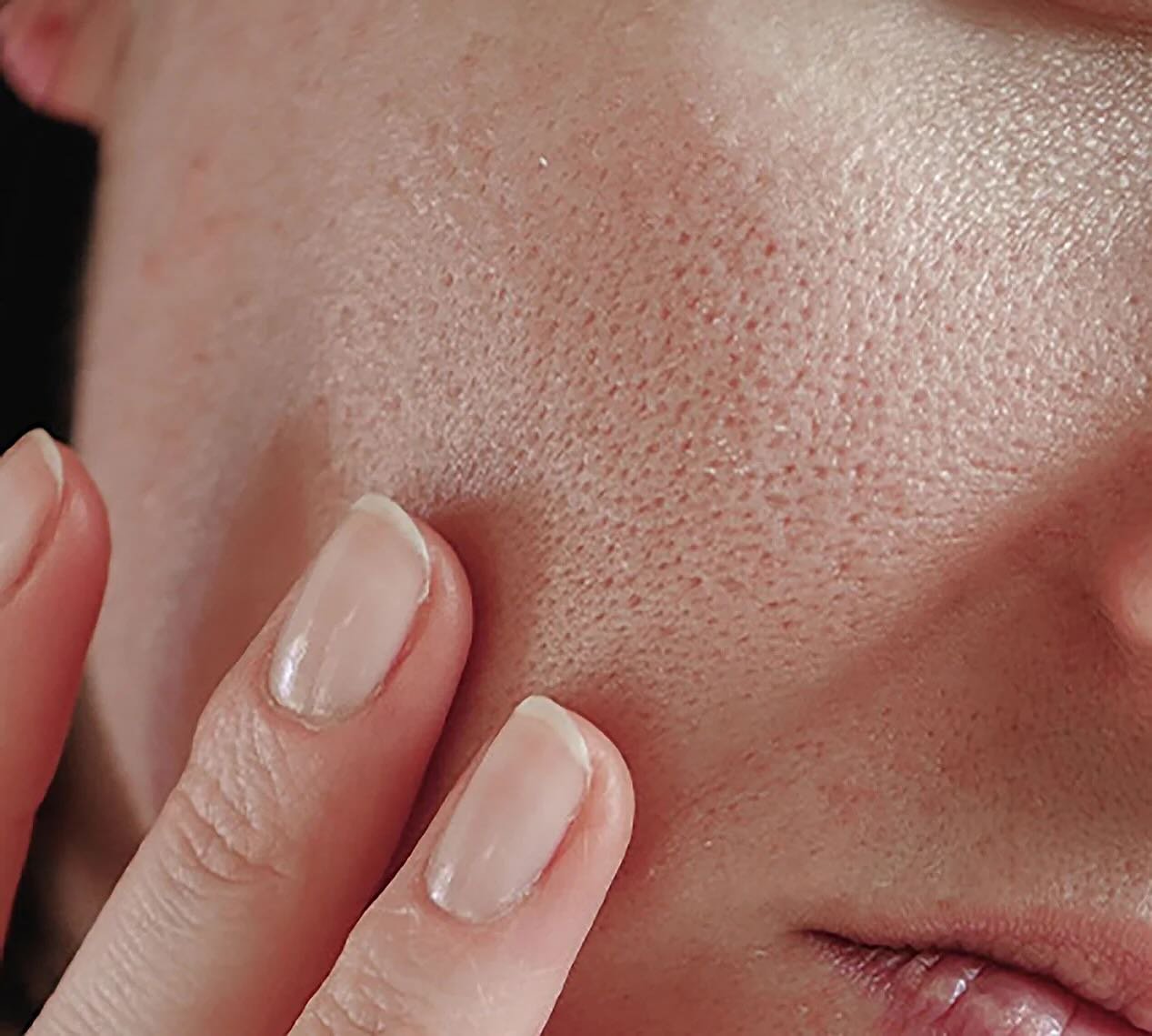 Pores feeling full with the summer heat? ☀️Book the Pore Refining Facial which includes deep pore cleansing, Mangosteen Lactic Pro Peel, specialty pore refining treatment and mask, and gua sha treatment.

Leave with clearer, more refined pores &amp; 