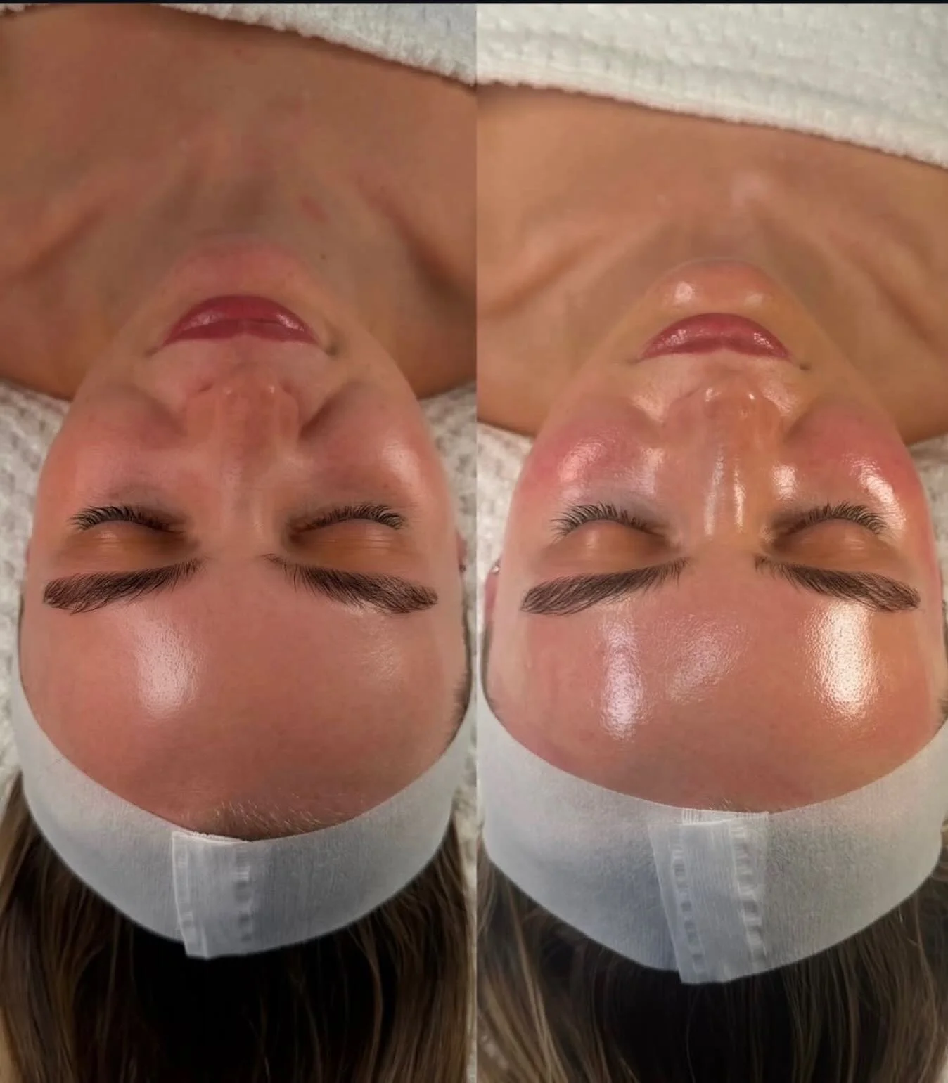 Brighter skin days ahead! 🤩

Looking for your brightest glow yet?
Add the Britenol booster to your next Hydratacial treatment.
It&rsquo;s designed to brighten and balanced skin tone while minimizing the appearance of dark spots. 🍊

Schedule your ne