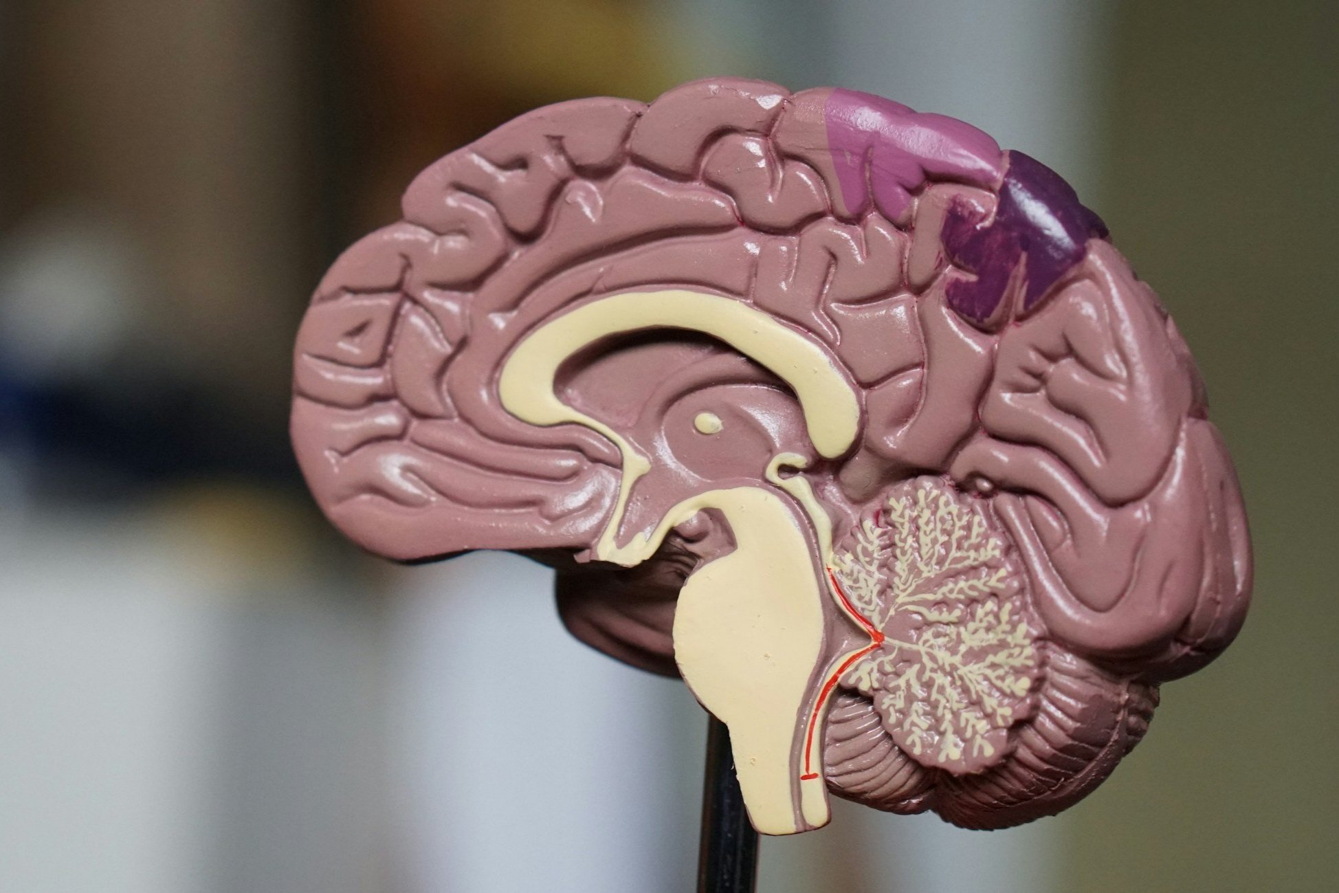 Stop this brain… I want to get off!