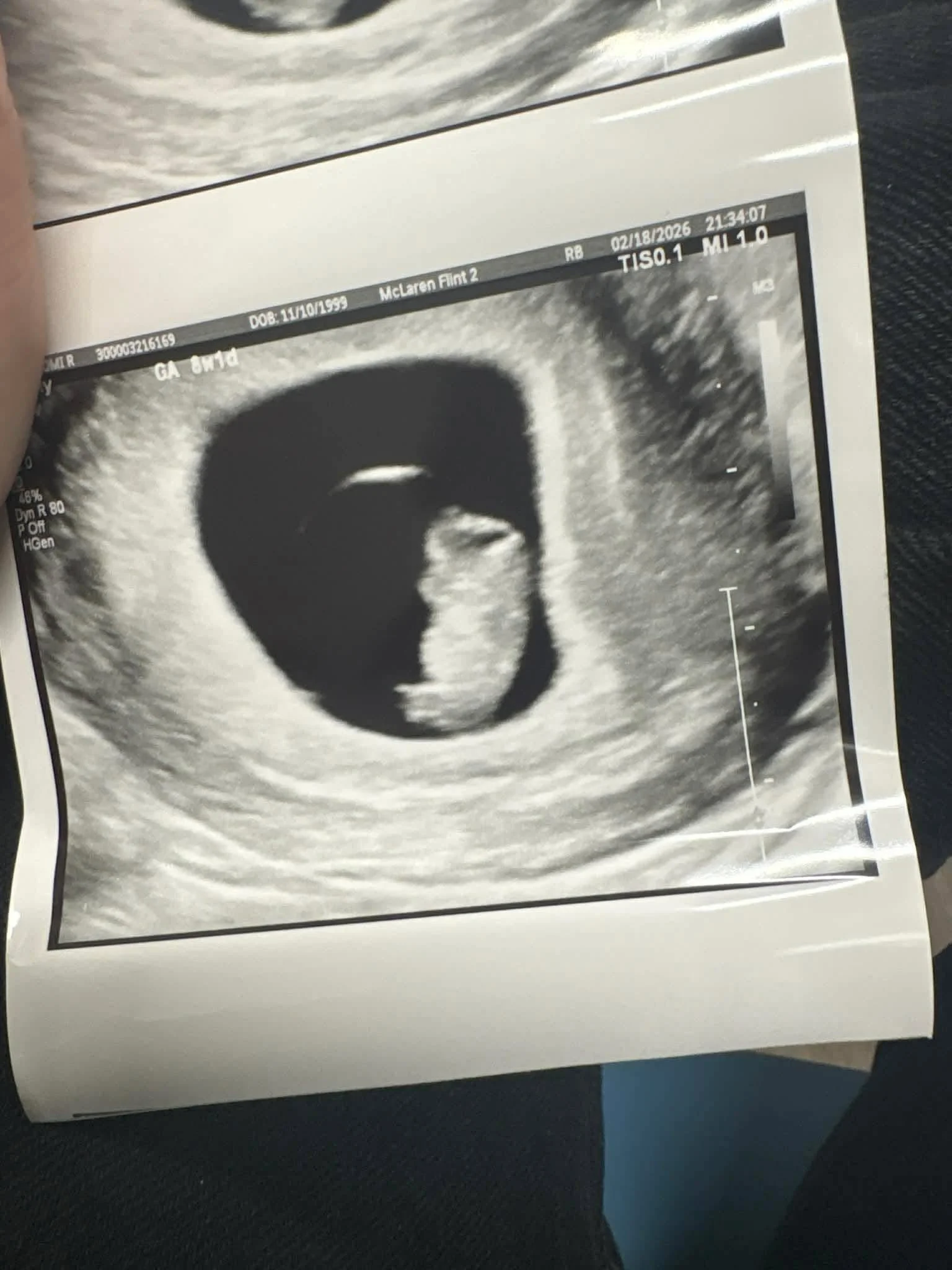 Ultrasound from McLaren hospital at 8 weeks. 

Today we got to hear the heartbeat and it&rsquo;s a strong heartbeat of 136 and little one was moving around so much made it hard to find them to get the heartbeat. So active already at 10 weeks 1 day is