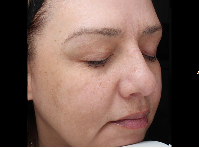 Close-up of a woman's face with clear skin, closed eyes, and natural makeup, showing freckles and smooth complexion.